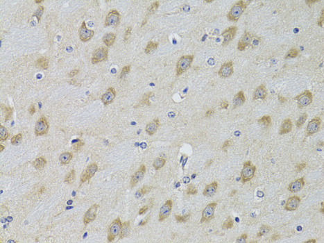 ADRBK2 Antibody