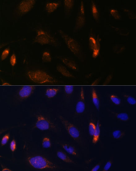 CHUK Antibody