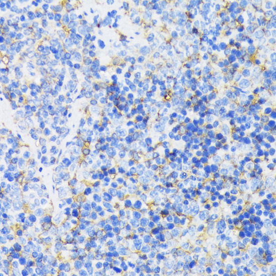 GSK3B antibody