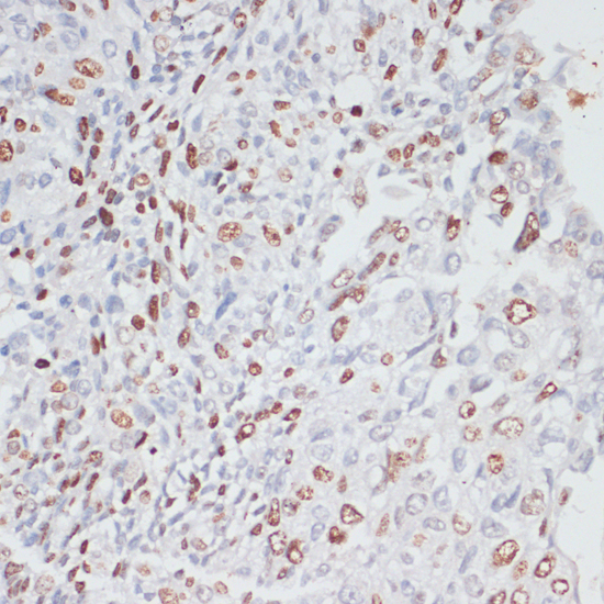 MKI67 antibody