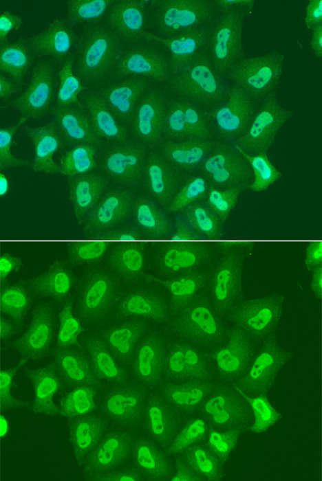 POLR2A Antibody