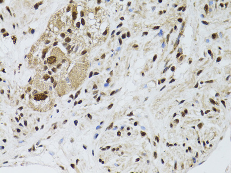 STK11 Antibody