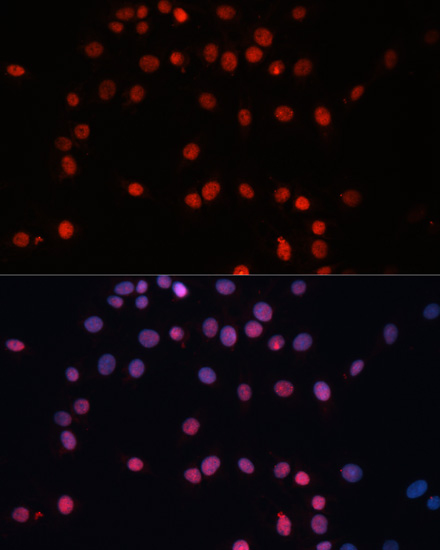 SUMO1 Antibody