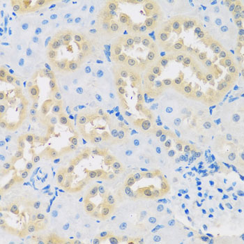 LETMD1 Antibody