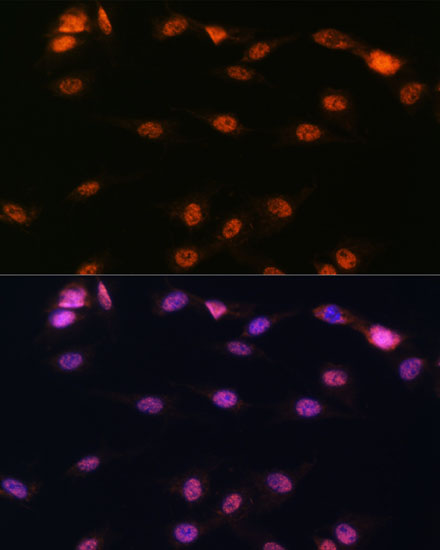 ALOX5 antibody