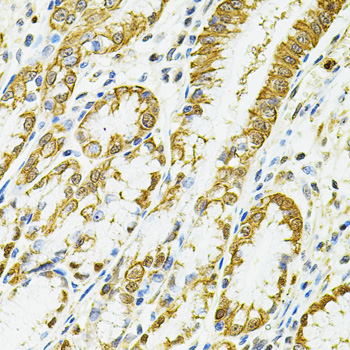 HLA-DQA1 antibody