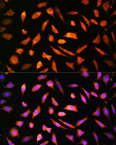 NPPB antibody