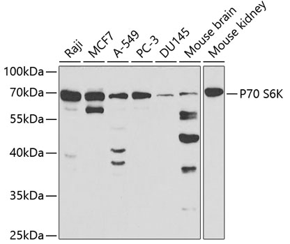 RPS6KB1 Antibody