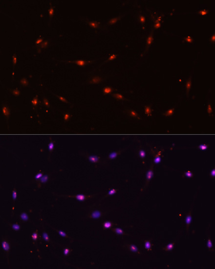 ILF3 antibody