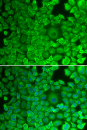 GYS1 antibody