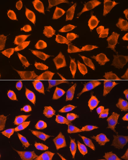 RPS3 Antibody