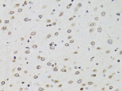 TMPO Antibody