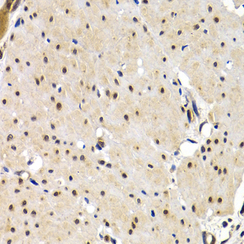 IRF2 antibody