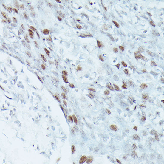 MEF2C Antibody