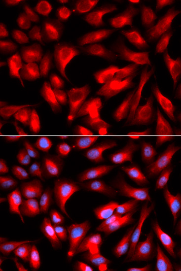 HMMR Antibody