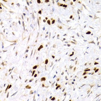 TP53 antibody