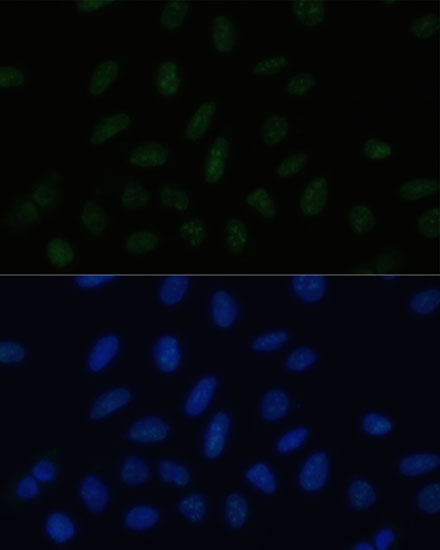 PELP1 antibody