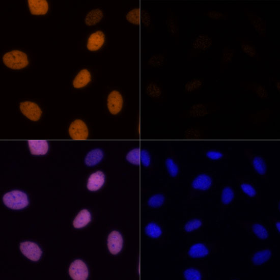 Acetyl-Histone H4-K16 pAb