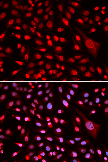 CBFB Antibody