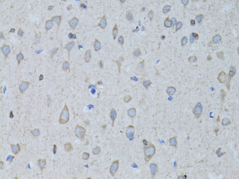 GABARAP Antibody