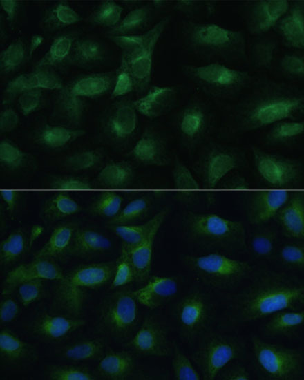 PGRMC1 Antibody