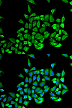 GSTP1 Antibody