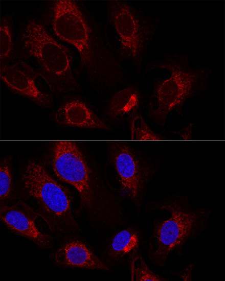 CS Antibody