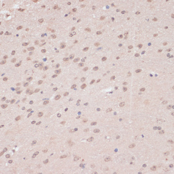 PRPF31 Antibody