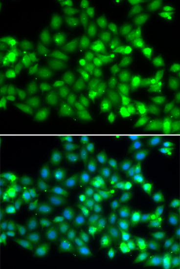 TRIM69 antibody