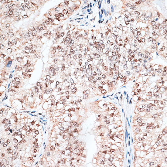 RBM3 Polyclonal Antibody