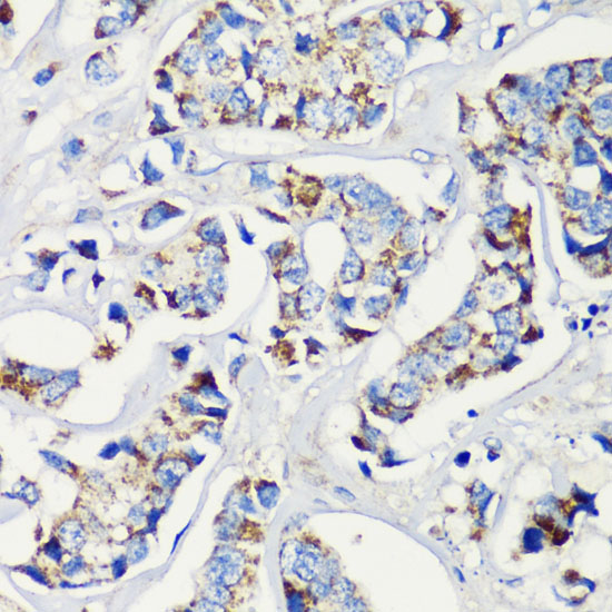 MLL5 antibody