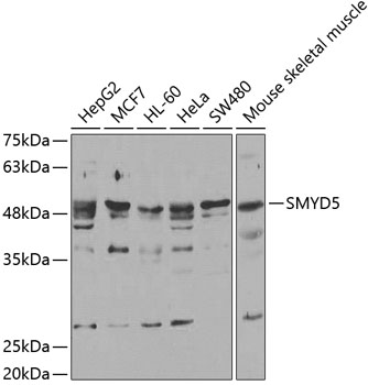 SMYD5 antibody