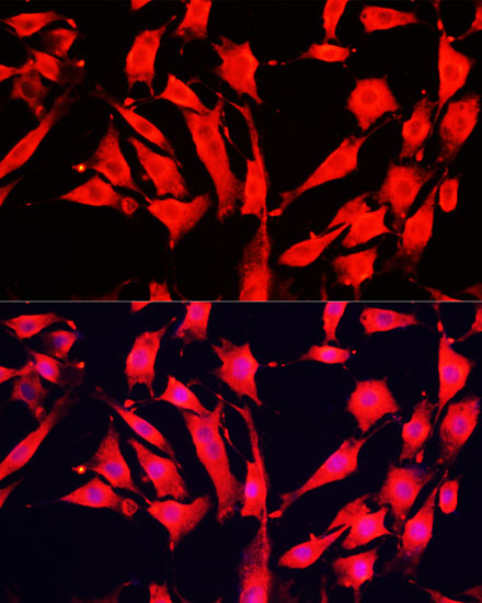 AOC1 antibody