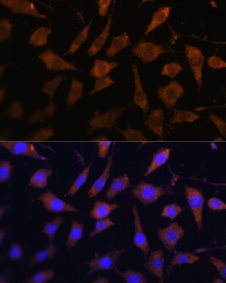 SERPINB9 antibody