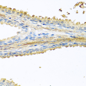 PIP antibody