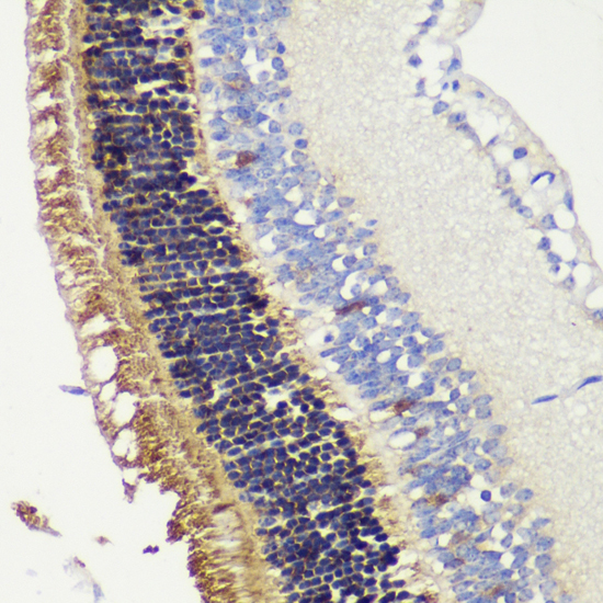 RCVRN antibody