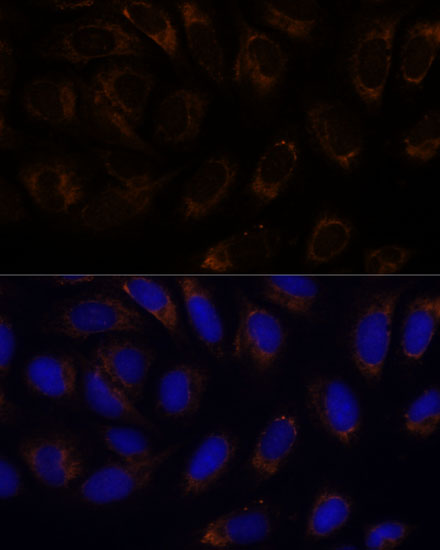 RAMP1 antibody