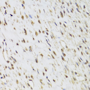 SEPHS1 antibody