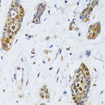 MMP10 Antibody