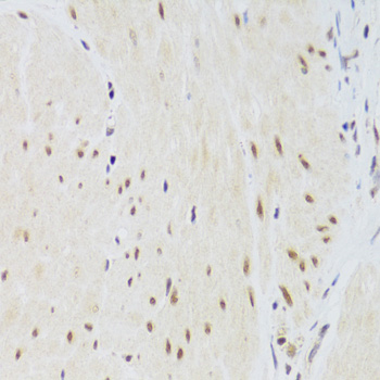 CSRP3 antibody