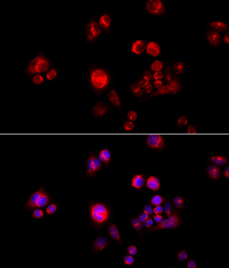 GLUD2 antibody