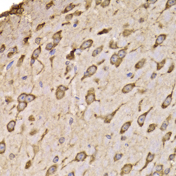 RPS14 antibody