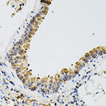 ARHGEF2 Antibody