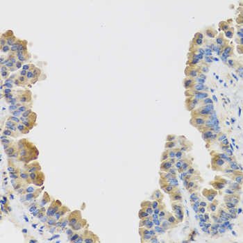 IL25 Polyclonal Antibody