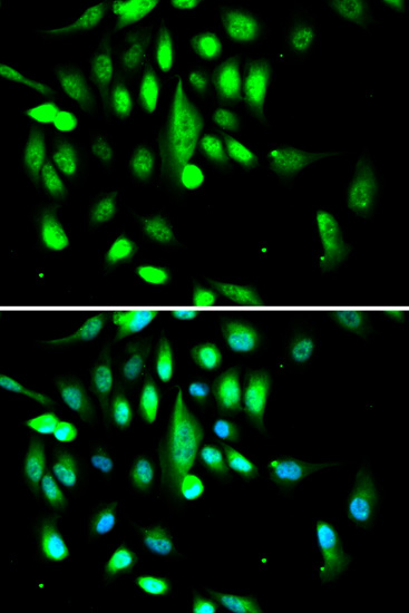 CDK1 Antibody