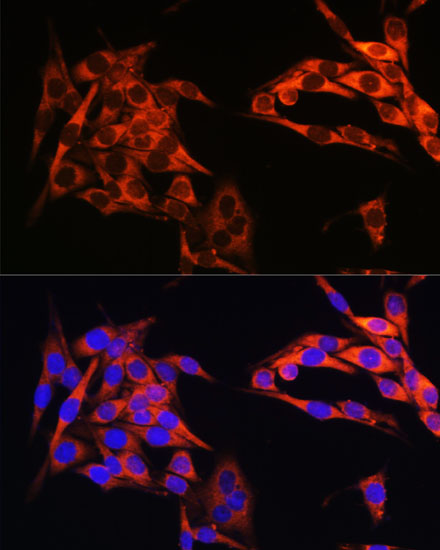 PIK3CA antibody