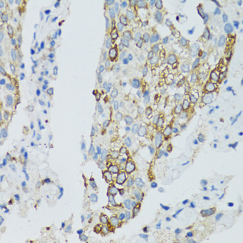 SIRT2 Antibody