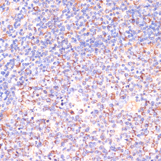 VHL Antibody