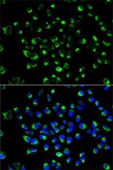 P4HB Antibody