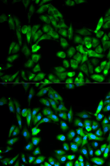 IKBKG Antibody